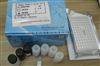 人可溶性血管細胞粘附因子-1（sVAP-1）ELISA試劑盒